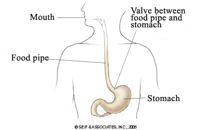 heartburn location