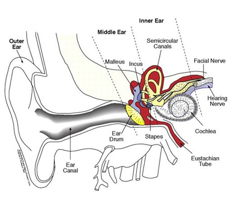 The Stapes in Otosclerosis: Osteoarthritis of an Ear Ossicle