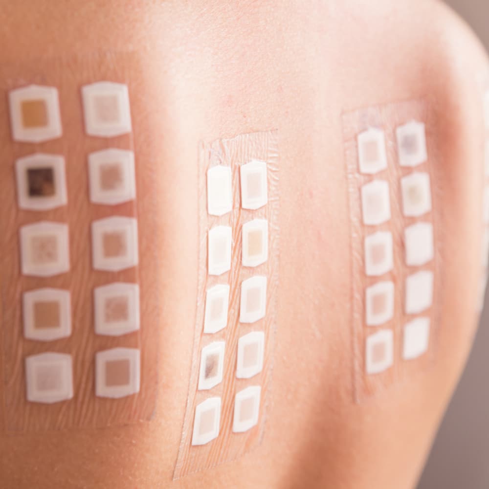 Close up image of a patch test on a patient's back